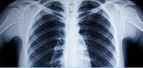 Services: Radiological Study Review